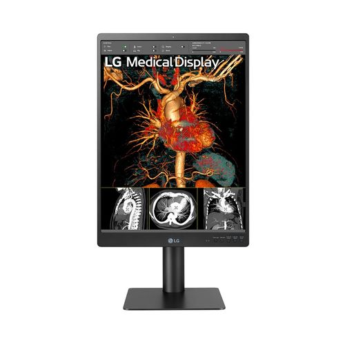 LG 21.3'' 3MP IPS Diagnostic Monitor