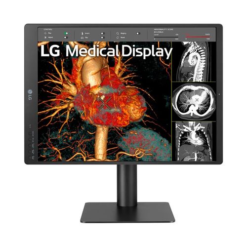 LG 21.3'' 3MP IPS Diagnostic Monitor